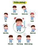 Các dấu hiệu và triệu chứng của cúm loại A